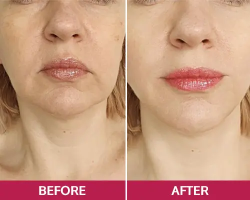 LunaSkin LunaSkin customer reviews