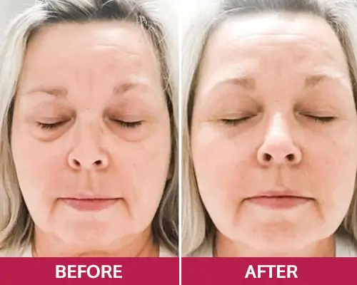 LunaSkin LunaSkin consumer reviews